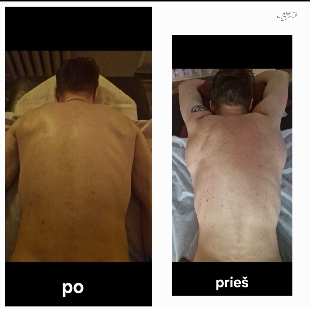 Nugaros masažas atliekamas Leonilės Tretiak MS053 - Image 5